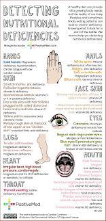 Detecting Nutritional Deficiencies Natural Health Holistic Health Health Remedies