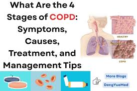 Image result for COPD Management