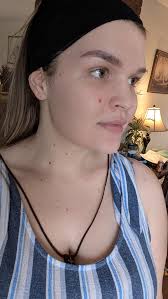 Microblading Removal