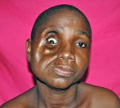 Earthwide Surgical Foundation: May 2012