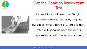 Image result for Ankle External Rotation Test