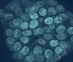 These are the signs that led nine women to a doctor, and ultimately a breast cancer diagnosis. Stages Of Breast Cancer National Breast Cancer Foundation