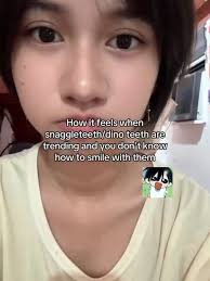 Alien Stage Why Is Ivans Teeth Like That