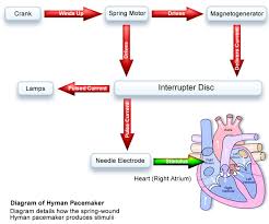 Pacemaker types according to the programming. A History Of Pacemakers