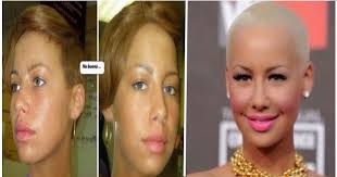 Photos Amber Rose Before And After Fame Amber Rose Plastic Surgery Gone Wrong Rose
