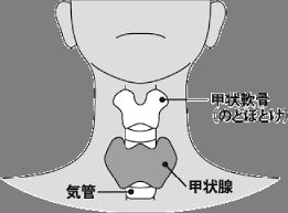 ダウン症者・児と内分泌代謝疾患