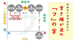 脳梗塞の経時的変化 覚える 変化 新人