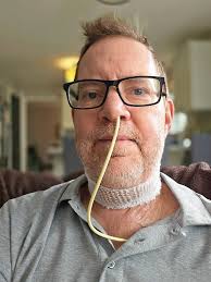 My sons have feeding tubes. Easiest way to feed a kid and you never have to  hear them complain about taste. I hope you get your swallow back and if  not, you