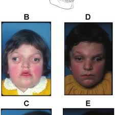 Photograph of Paul Louis Auguste Ernest Tessier (August 1, 1917-June 6,... 