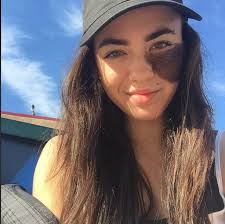 Isn't she beautiful? This dancer loves her hairy birth mark and is an  inspiration