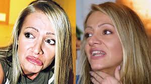 Her music career began at the age of nine, after being cast in the television musical zázračný autobus (1981). Zkazene Plastiky Celebrit Dil Iv Zborceny Nos Dary Rolins A Vymena Silikonu Extra Cz