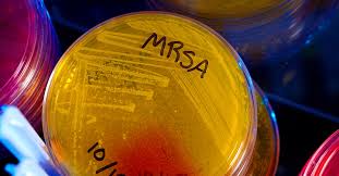 In some cases, it causes pneumonia (lung infection) and other infections. The Coming Cost Of Superbugs 10 Million Deaths Per Year Wired