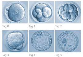 Acum este timpul să așteptați până când se va produce fertilizarea. Kinderwunsch Behandlung Blastozystenkultur
