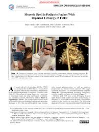 Image result for Pediatric Spell