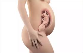 Check spelling or type a new query. 36 Schwangerschaftswoche Erste Ubungswehen Braxton Hicks Kontraktionen