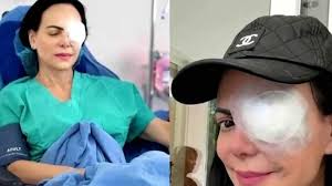 Muere Conductor en Choque Frontal con Tráiler en Carretera Gómez  Palacio-Jiménez