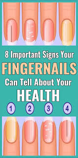 8 Things Your Nails Can Tell You About Your Health Nail Symptoms Fingernails Health