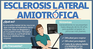 Hacer rm del cerebro y las pruebas de electrodiagnóstico y de laboratorio para excluir otros trastornos. Site Salud