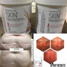 Wine Making Kits Walmart Winemakingjuice Skintighteningcellulitetreatment Herbalife Herbalife Recipes Herbalife Nutrition