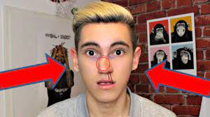 Nase Gebrochen Miguel Pablo Youtube