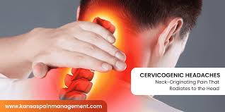Image result for Spinal Headache