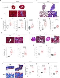 In fact, more than half of all heart. Plos One Transgenic Interleukin 11 Expression Causes Cross Tissue Fibro Inflammation And An Inflammatory Bowel Phenotype In Mice