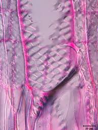 Image result for Discopodium penninervium