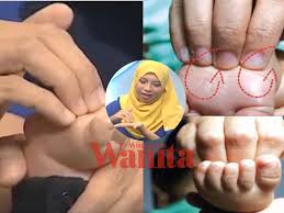 Obat kesemutan tangan apa saja yang paling alami dan efektif untuk dicoba? 3 Teknik Urutan Mudah Tapak Kaki Terapi Berkesan Untuk Legakan Selsema Bayi Mingguan Wanita