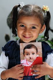 Operation Smile Jordan