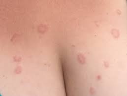 Profitez de millions d'applications android récentes, de jeux, de titres musicaux, de films, de séries, de livres, de magazines, et plus encore. Definiciones Dermatologia Archives Seite 38 Von 233 Dermatly Com El Sitio De Tu Piel