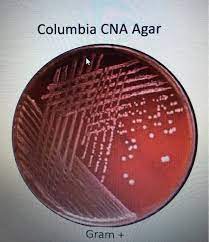 Pasteurella only grows on the blood agar plate. Solved What Type Of Hemolysis Test Result Is This On The Chegg Com