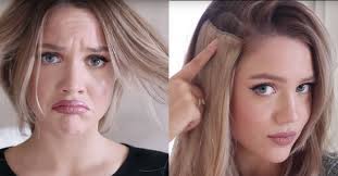 We have seen many patients that come to our practice and either have a history of using these products or are currently using them. Do Hair Extensions Cause Hair Loss St Gerard Center