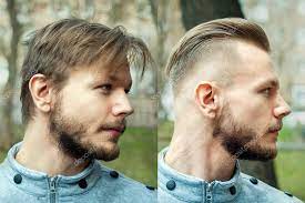 A gallery of men sporting different looks before and after a haircut, from fauxhawk to burr to shag to crew. Bald Man Before After Haircut Concept For A Barber Shop The Problem Man Of Hair Loss Alopecia Transplantation Side 379304404 Larastock