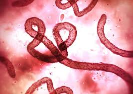 Jun 25, 2021 · gambar hiasan. Virus Ebola Serang Kongo 33 Orang Dinyatakan Tewas