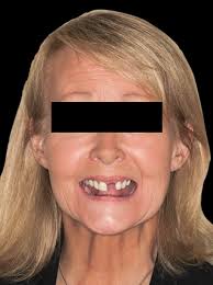 Creating smiles and changing lives Implementing 3D printing in practice  Driving the digital evolution