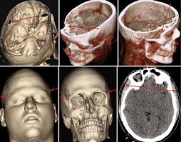 🗓 Today marks the 2️⃣8️⃣0️⃣th anniversary since the birth of Mikhail  #Kutuzov, a legendary figure in the #RussianHistory, a finest Russian  commander and diplomat. Born #OTD in 1745 into a noble family,