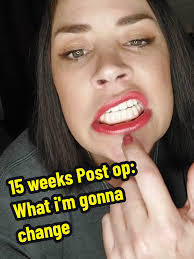 Ashley Layne No Teeth