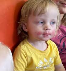 Kids diagnosed with this condition, how was it diagnosed?