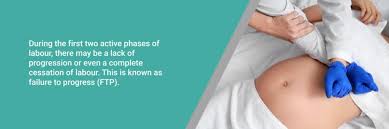 Image result for Failure to Progress