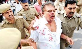 Sasikala pushpa is the member of the parliament of india representing tamil nadu in rajya sabha. Husband Of Expelled Mp Sasikala Pushpa Left Bloody And Battered By Aiadmk Cadres After Refusing To Leave Party Hq Daily Mail Online