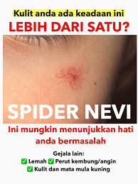 Tapi tahukah anda apa punca sebenar buku lali dan siku dan secara tidak langsung akan menjadi kasar. Facebook