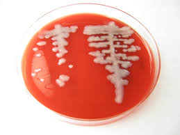 Image result for Rhizobium radiobacter, syn. Agrobacterium tumefaciens