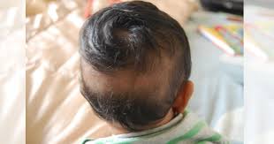 Jika ada seorang bayi yang belum dicukur ketika hari ketujuh setelah kelahiran, bolehkah dia dicukur setelah itu? Risau Rambut Bayi Tumbuh Tak Sekata Tip Ini Berkesan Merawat Dari Awal Pa Ma