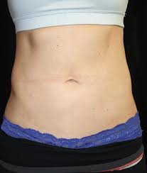 Image result for Umbilicus