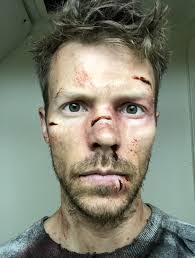 Brian Dare's Instagram, Twitter & Facebook