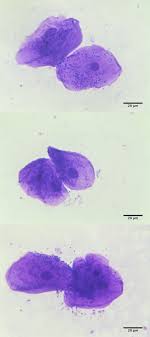 Cheek cells are easy to obtain and easy to see under a microscope. Cheek Cells Under A Microscope