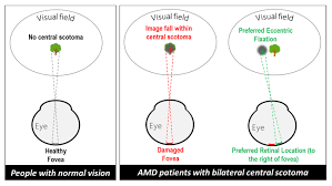 Image result for Visual Fixation
