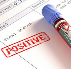 Wie man neuerdings selbst testen kann, ob man hiv hat. Aids Diagnose Hiv Wird In Vielen Fallen Zu Spat Entdeckt Welt