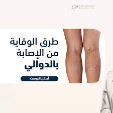 طرق الوقاية من مرض دوالي الساقين تحاشي الوقوف لمدة زمني ة طويلة فلا بد من الجلوس ولو لدقائق قليلة بين الحين والآخر مع الحرص على ت doctor style clinic doctor