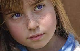 We did not find results for: Purple Eye Disease Symptoms And Causes